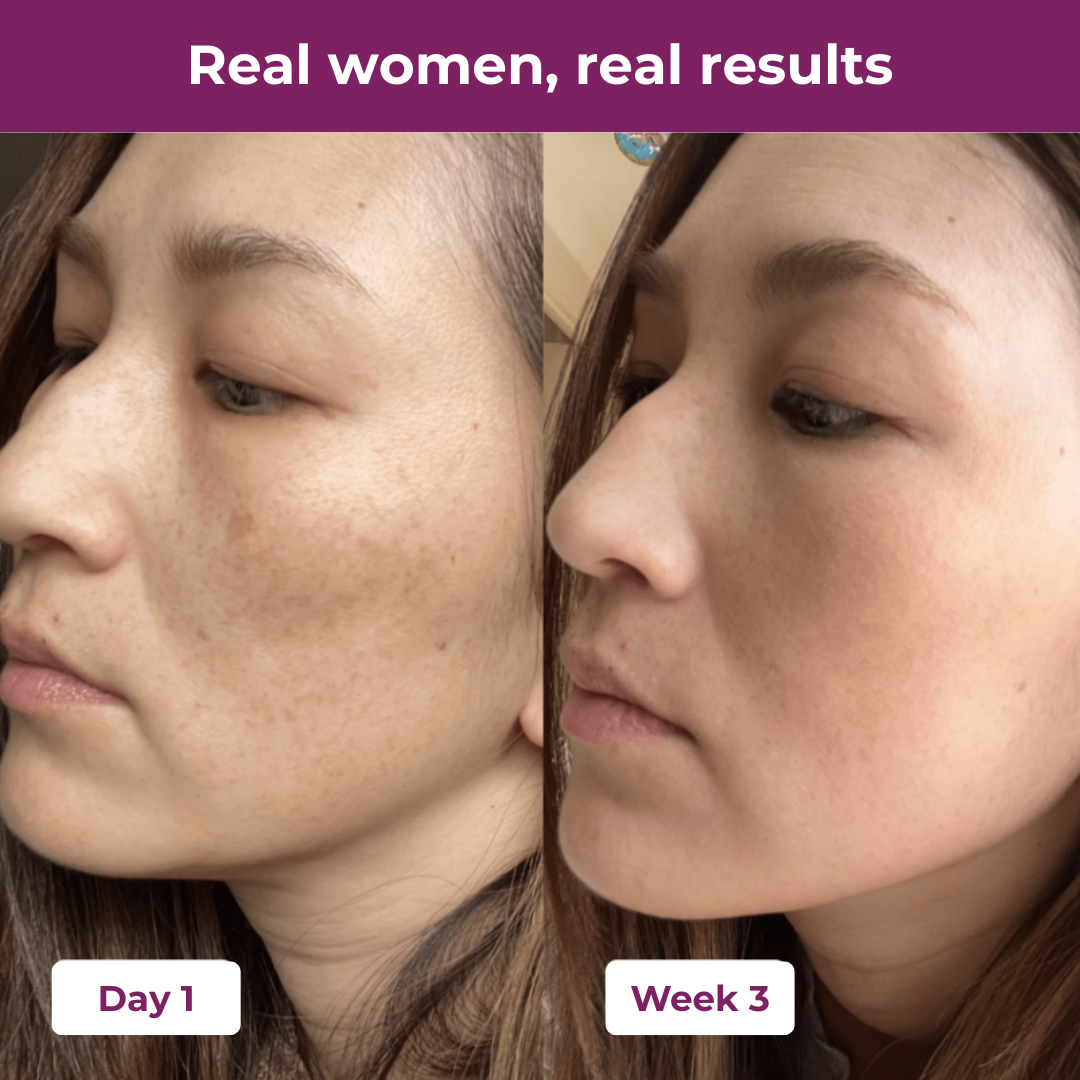Calcie Collagen Peptides