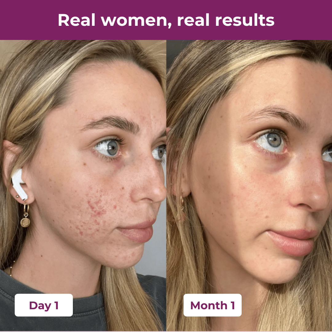 Calcie Collagen Peptides